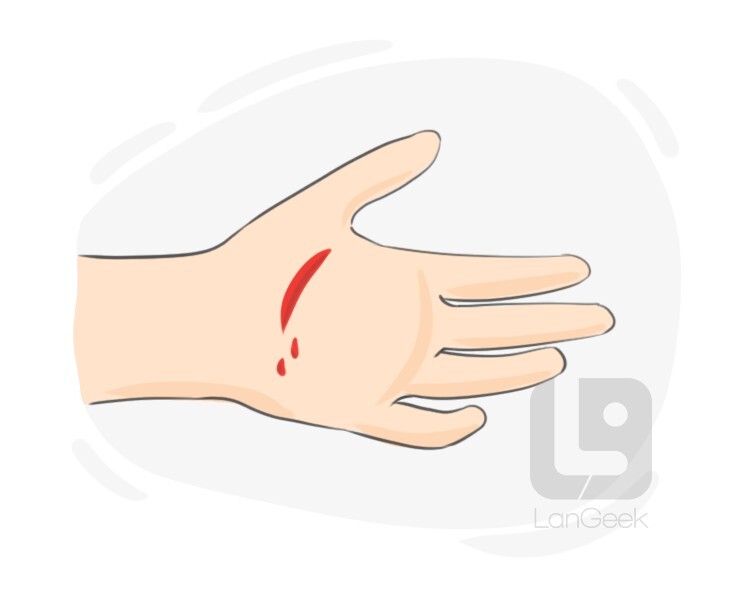 laceration definition and meaning