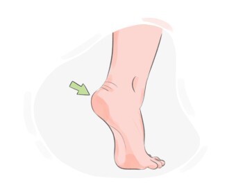 heel
