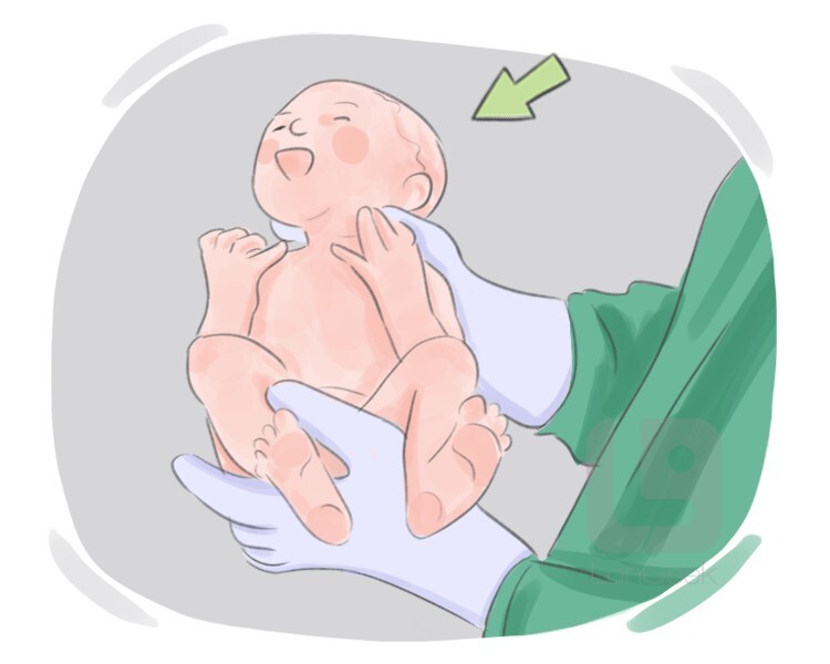 neonate definition and meaning