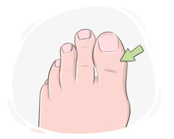 big toe