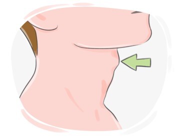 thyroid cartilage