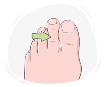toe