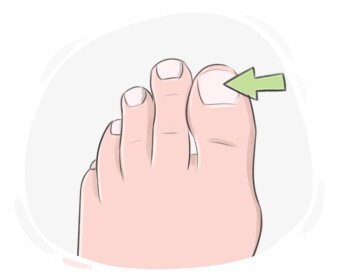 toenail