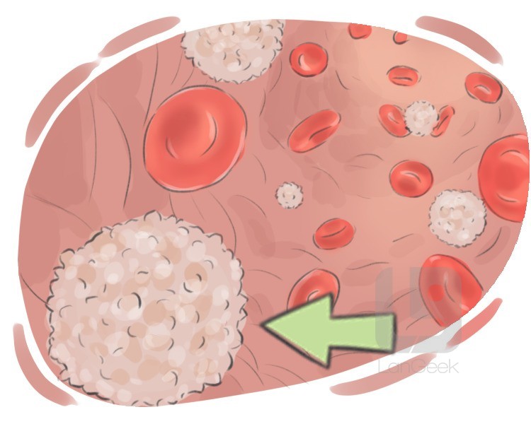white blood cell definition and meaning
