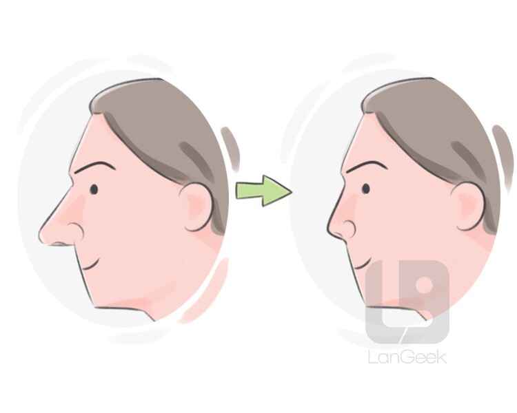 Definition & Meaning of "Rhinoplasty" | LanGeek