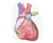 pulmonary artery
