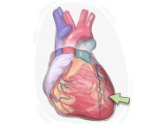 ventricle