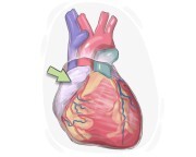 right atrium