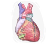 right ventricle