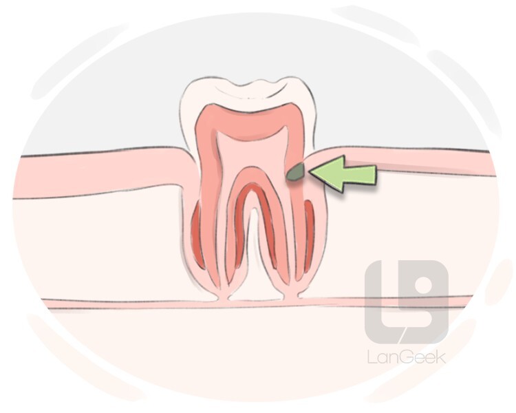 root cavity definition and meaning