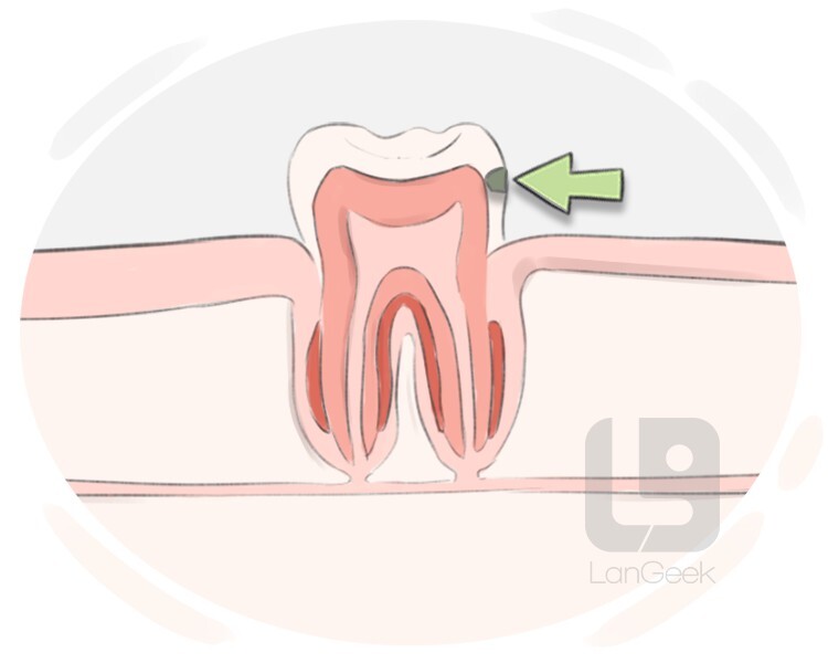 smooth cavity definition and meaning