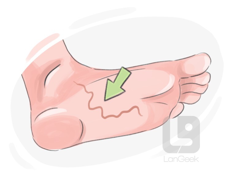 Definition & Meaning of Hookworm