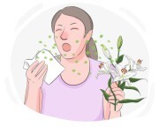 allergy