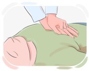 cardiopulmonary resuscitation