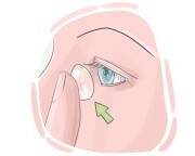 contact lens