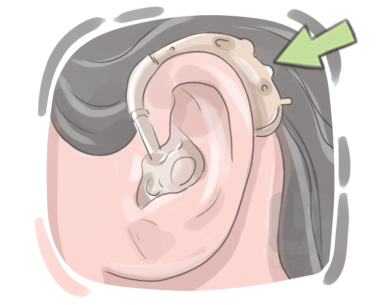 hearing aid definition and meaning