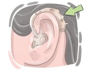 hearing aid