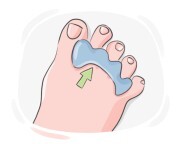toe separator