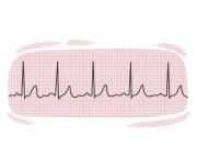 electrocardiogram