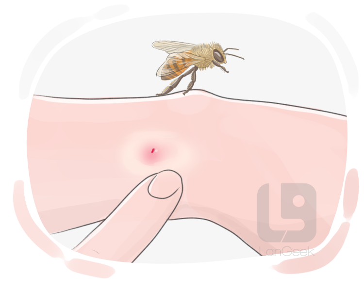 bee sting definition and meaning