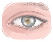 eye