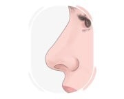 nose