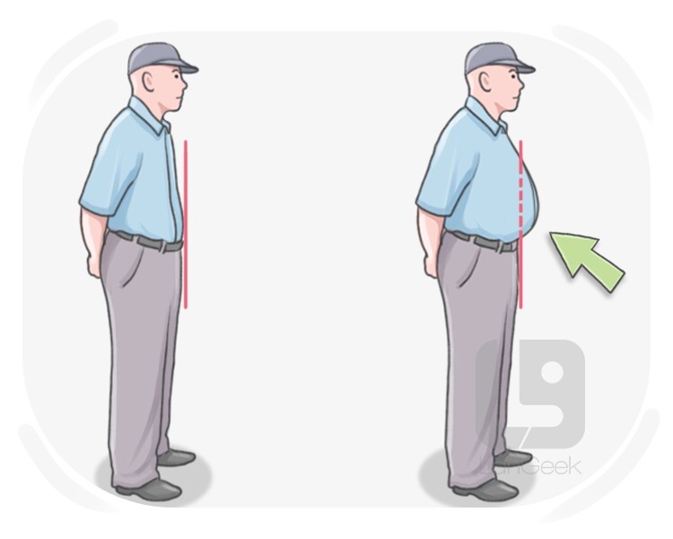 protruding definition and meaning