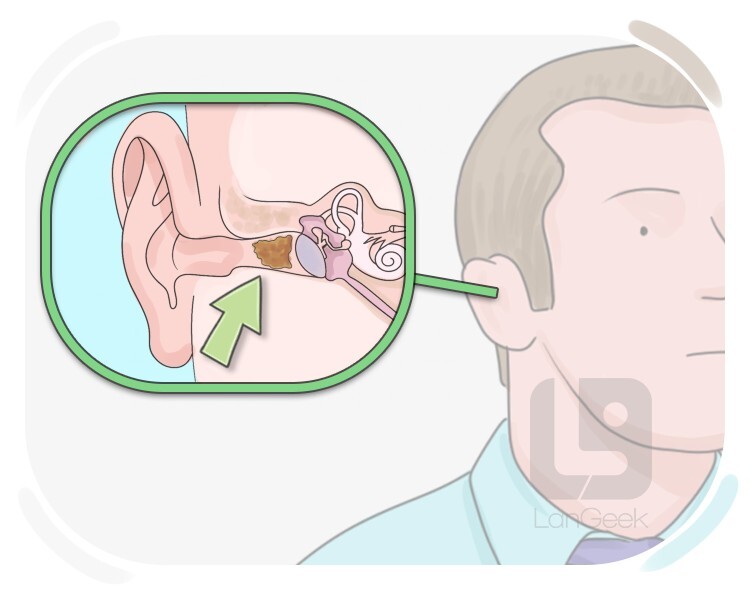 earwax definition and meaning