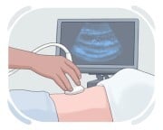 ultrasound