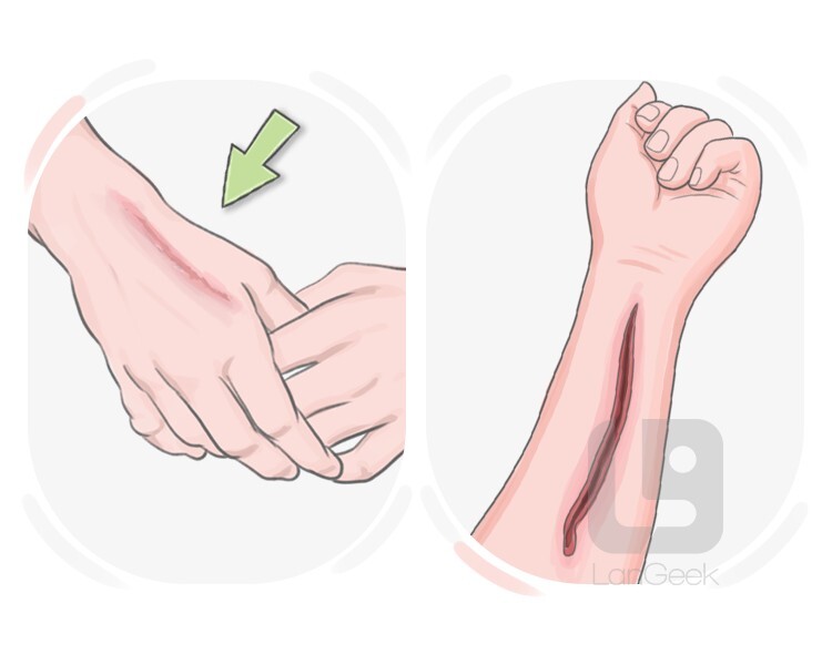 superficial definition and meaning