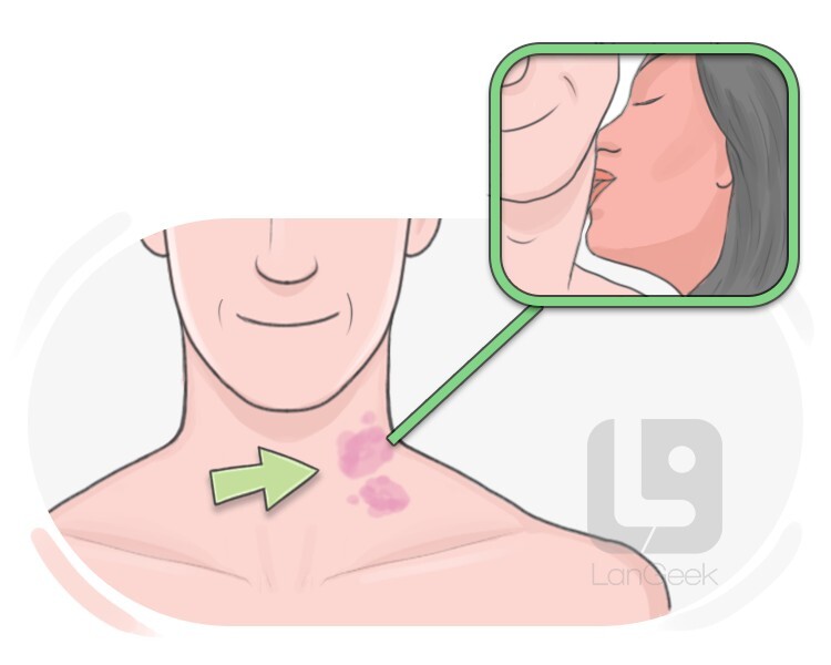 hickey definition and meaning