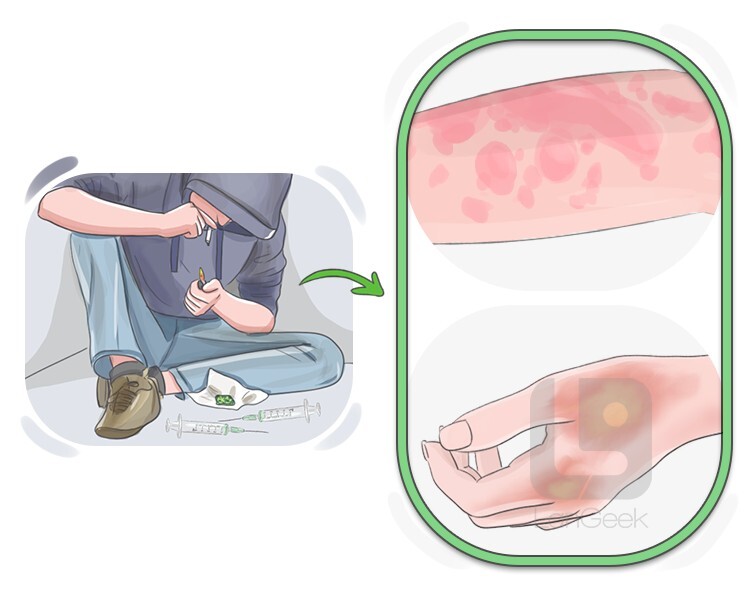 harmful definition and meaning