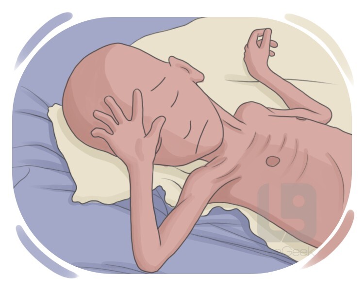 starvation definition and meaning