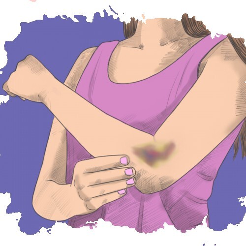 Heridas y los primeros auxilios
