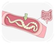 parasite